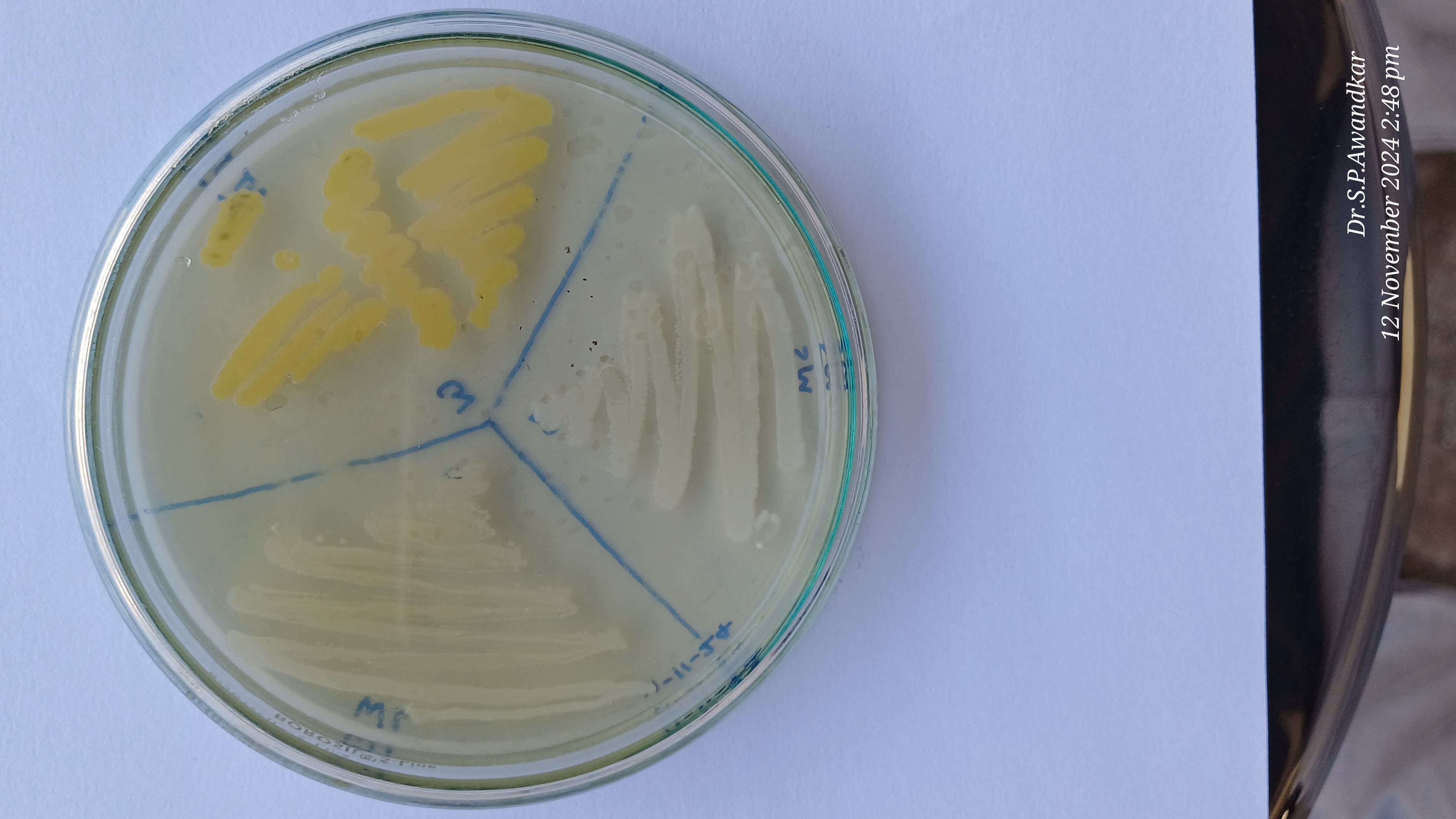 17. Staphylococci Spp